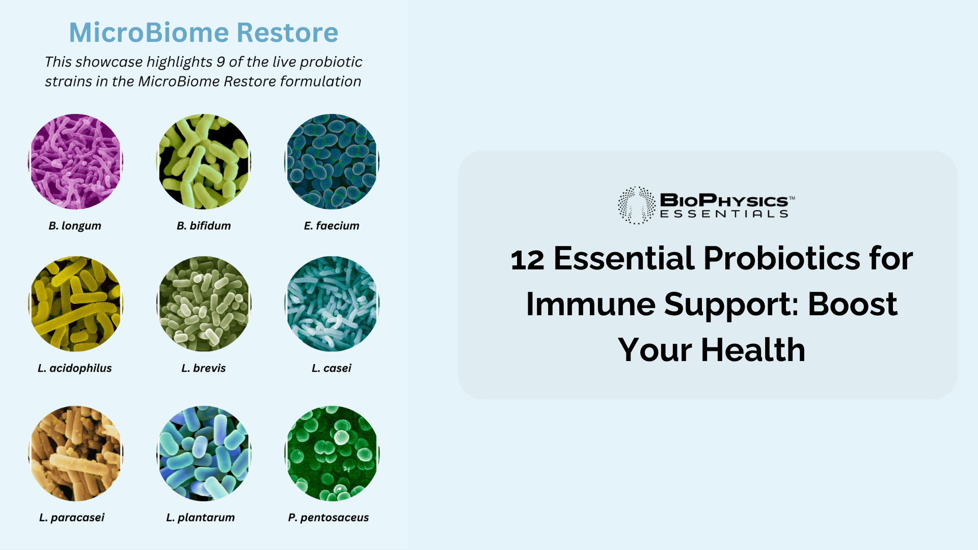 12 Essential Probiotics for Immune Support: Boost Your Health