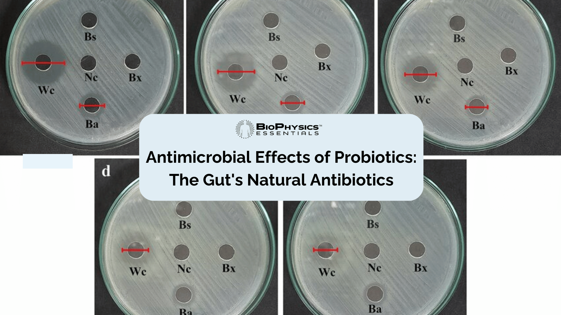 Antimicrobial Effects of Probiotics: The Gut's Natural Antibiotics
