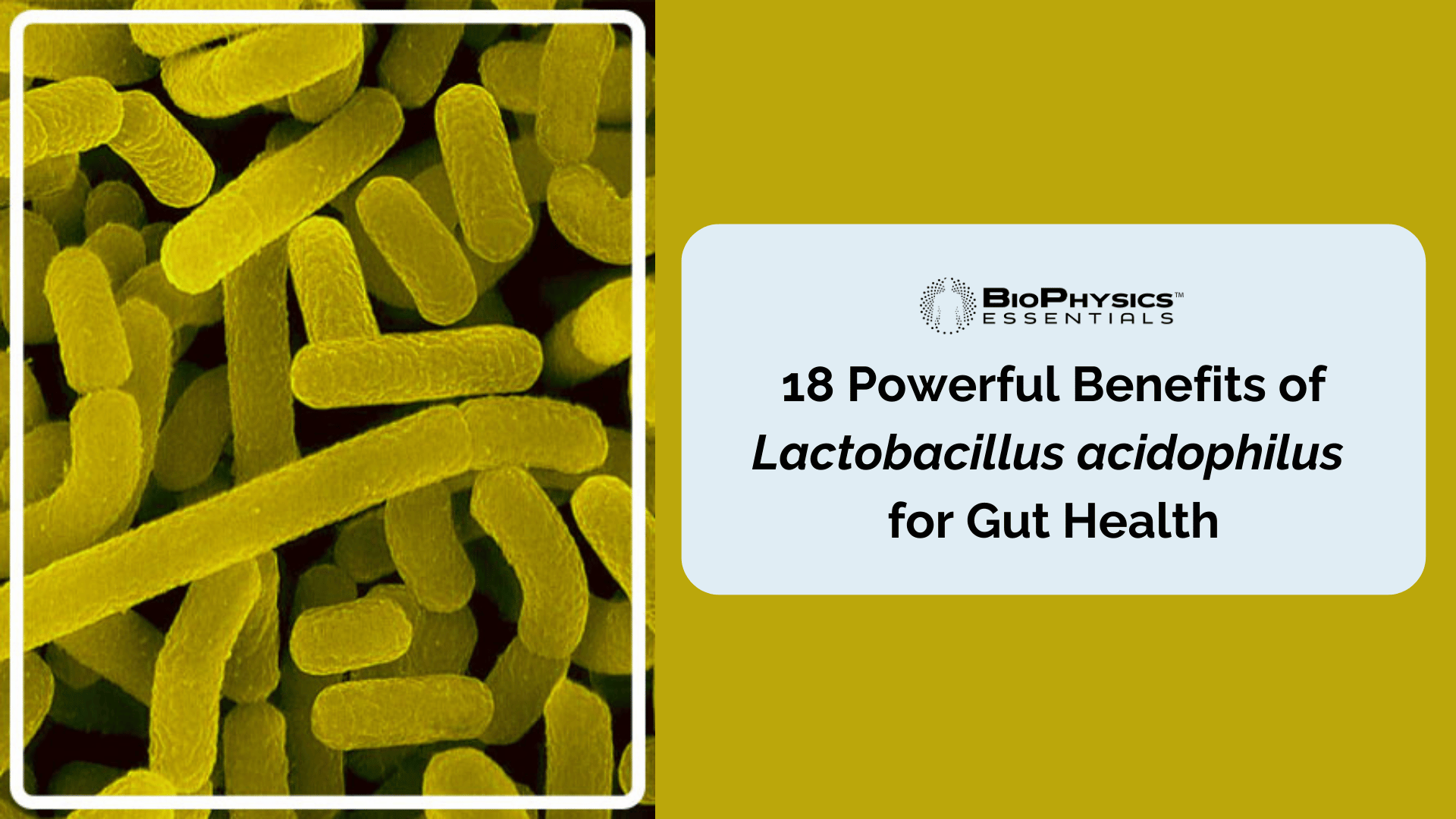 18 Powerful Benefits of Lactobacillus acidophilus for Gut Health - And Where To Find It