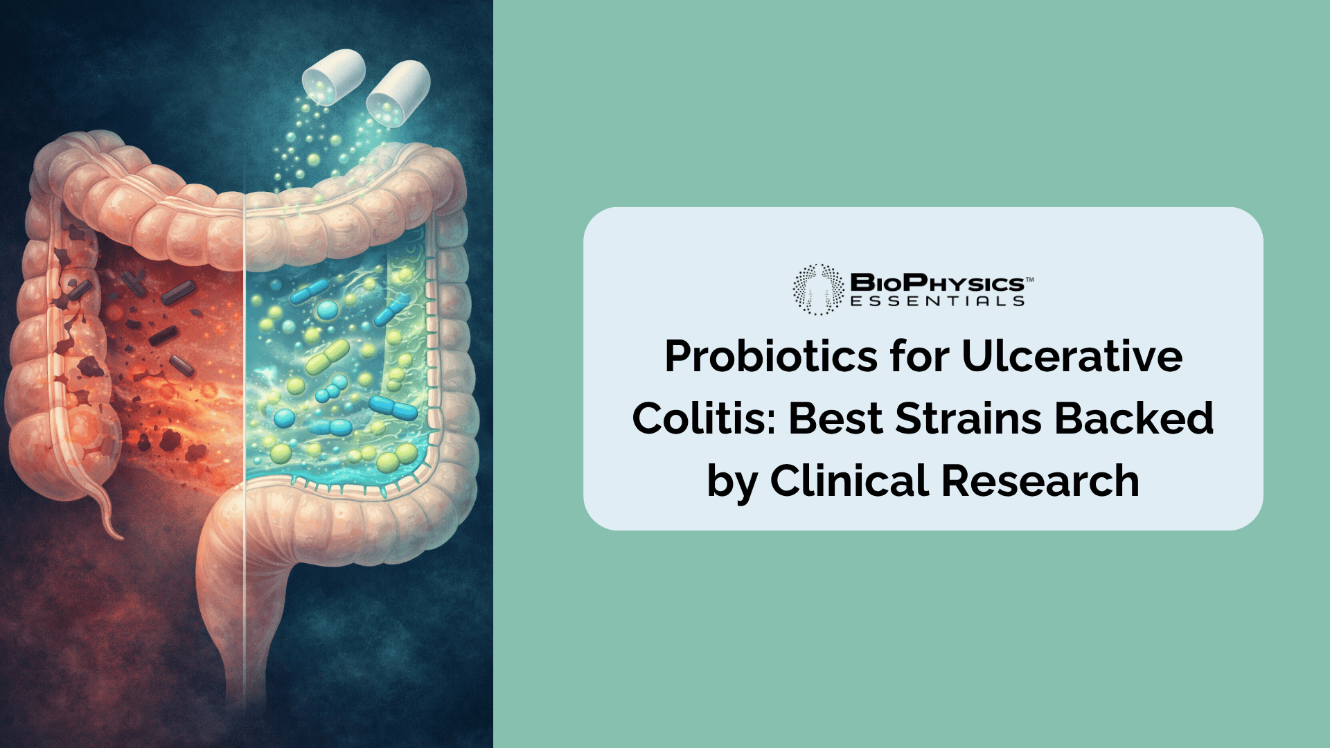 cross-section of the human colon with a split view contrasting inflamed depleted gut microbiome on the left with a thriving restored probiotic-rich microbiome on the right, representing how probiotic supplementation supports ulcerative colitis recovery